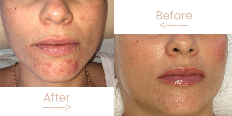 before-after-gg-1