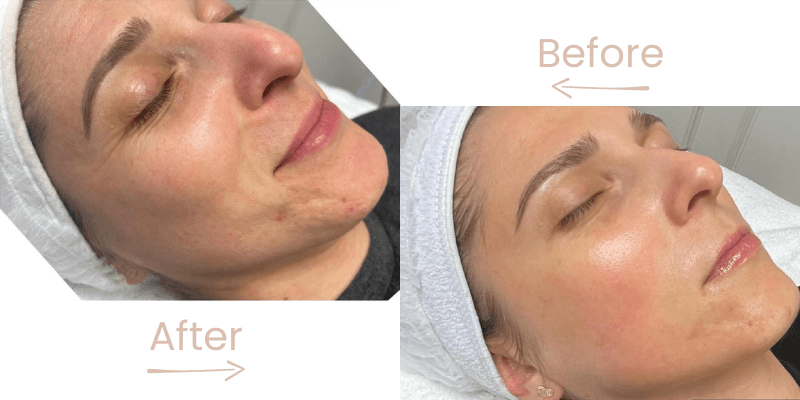 before-after-gg-2