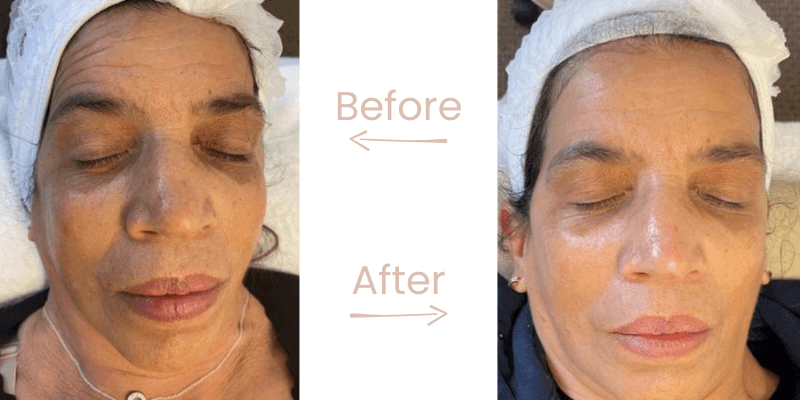 before-after-gg-3