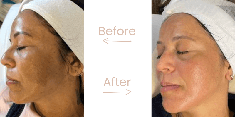 before-after-gg-6
