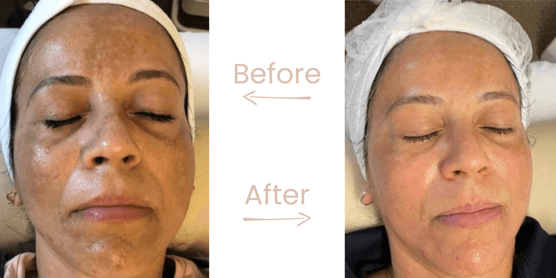 before-after-gg-9
