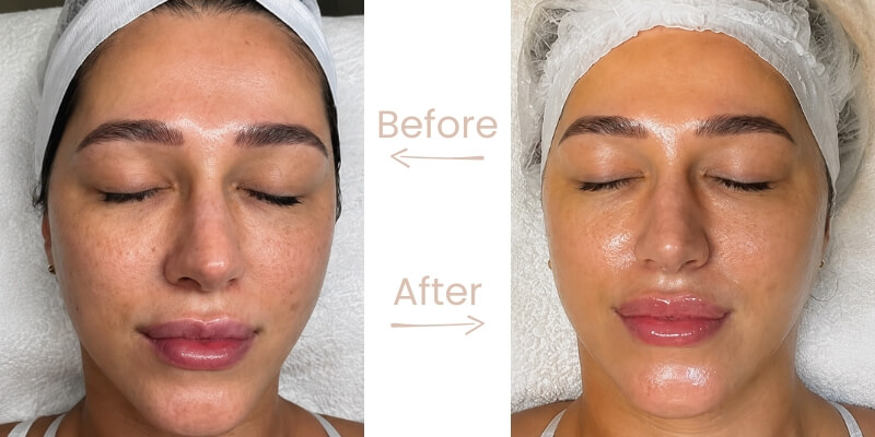 before-gg-after-17 (1)
